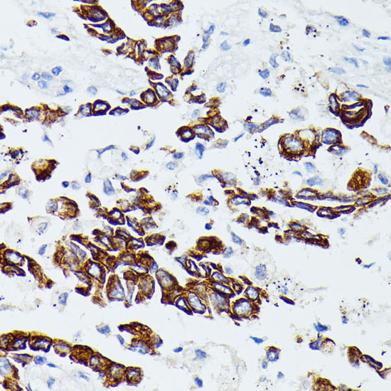 a07939 mmp25 primary antiboties ihc testing 3