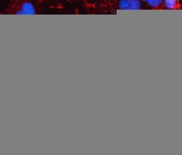  IF analysis of LAD1 using anti-LAD1 antibody (A07940)