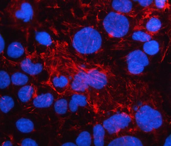 a07940 lad1 primary antibodies if testing 2_1