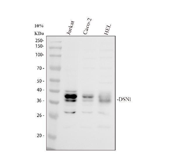 Western blot analysis of DSN1 using anti-DSN1 antibody (A07949-2)