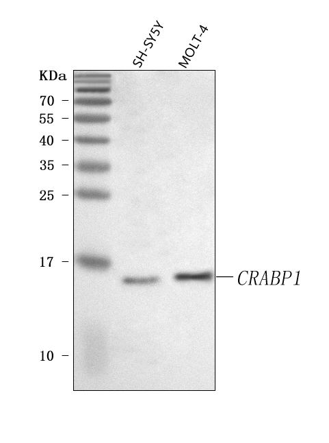  Western blot analysis of CRABP1 using anti-CRABP1 antibody (A07951-1)