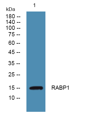 Western blot analysis of lysates from SW480 cells, primary antibody was diluted at 1:1000, 4°over night