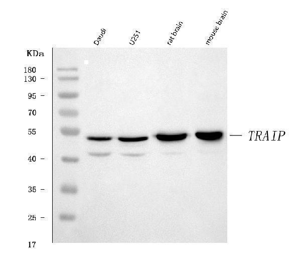  Western blot analysis of TRIP/TRAIP using anti-TRIP/TRAIP antibody (A07953-2)