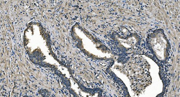 a07954 1 dnajc10 primary antibodies ihc testing 4
