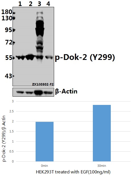 a07956y299 dok2 primary antiboties wb testing 1