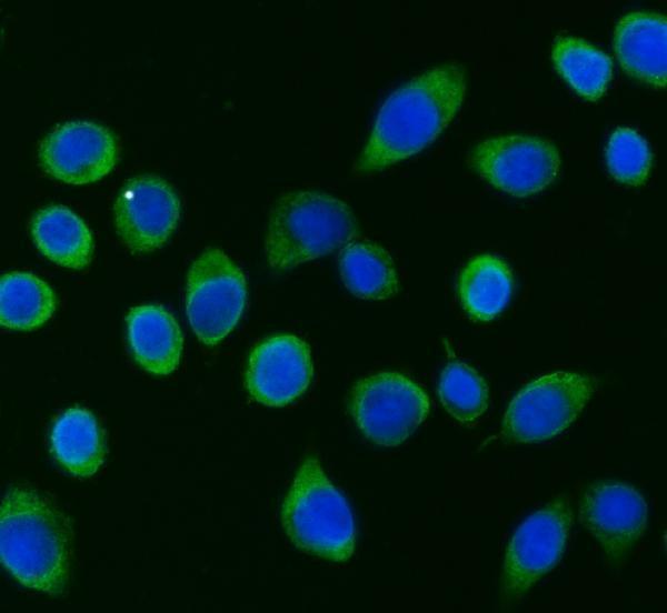 a07960 2 pabpc4 primary antibodies if testing 4
