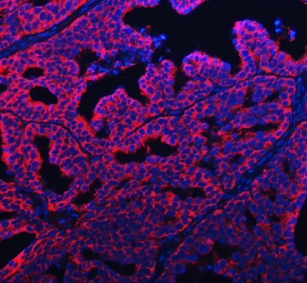 a07960 2 pabpc4 primary antibodies if testing 8