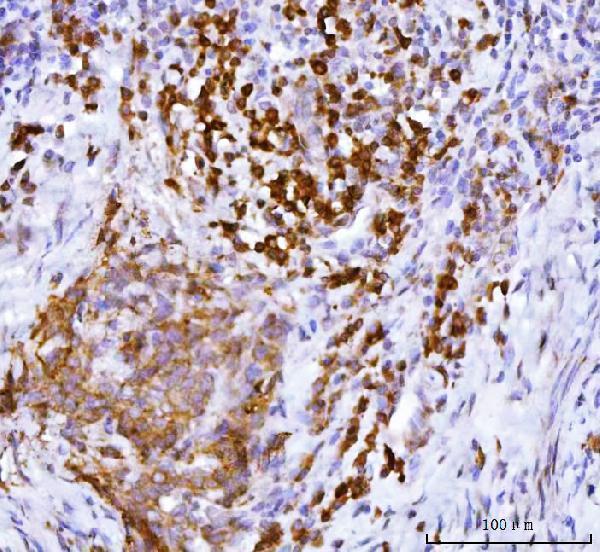 a07960 2 pabpc4 primary antibodies ihc testing 2