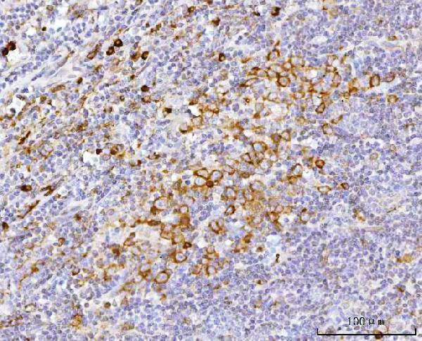a07960 2 pabpc4 primary antibodies ihc testing 3