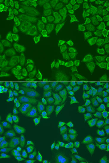 a07960 pabpc4 primary antiboties if testing 4