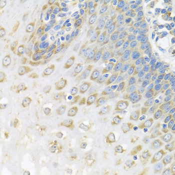 a07960 pabpc4 primary antiboties ihc testing 2