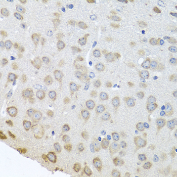 a07960 pabpc4 primary antiboties ihc testing 3