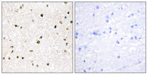Immunohistochemistry analysis of paraffin-embedded human brain tissue, using AKAP11 Antibody