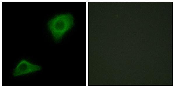 a07965 gpat3 primary antibodies if testing 1