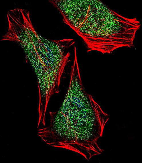 a07966 1 anti ecsit antibody c term if testing 1