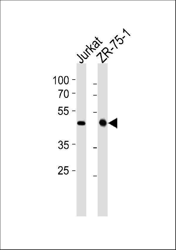 a07966 1 anti ecsit antibody c term wb testing 2