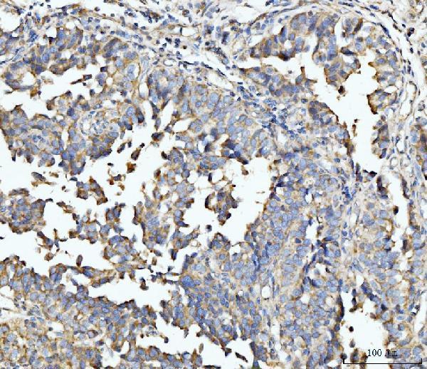 a07966 3 ecsit primary antibodies ihc testing 3