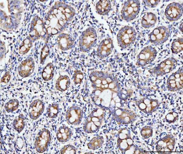 a07966 3 ecsit primary antibodies ihc testing 4