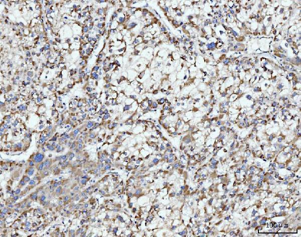 a07966 3 ecsit primary antibodies ihc testing 5