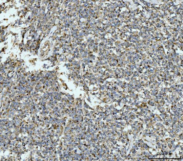 a07966 3 ecsit primary antibodies ihc testing 6
