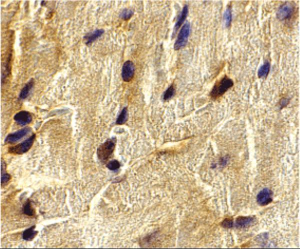 a07966 ecsit primary antibodies ihc testing 2