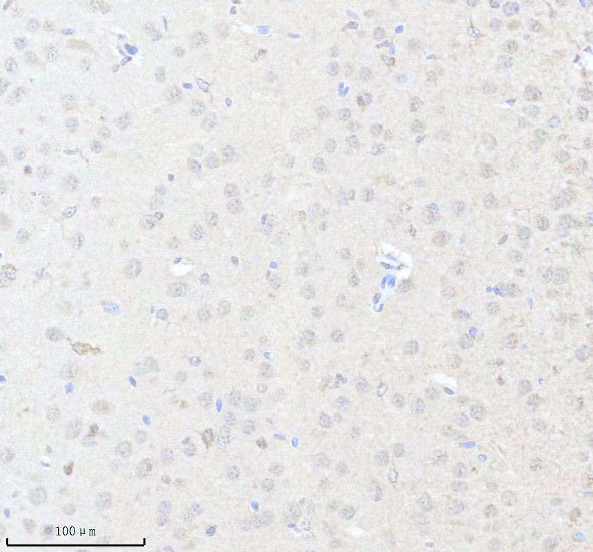IHC analysis of UGT8 using anti-UGT8 antibody (A07967-2)