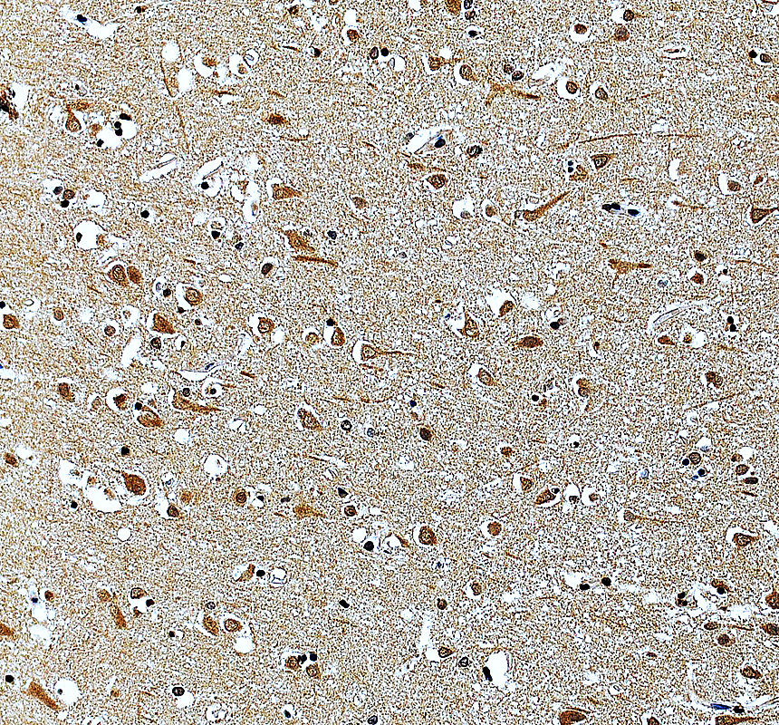 IHC analysis of UGT8 using anti-UGT8 antibody (A07967-2)