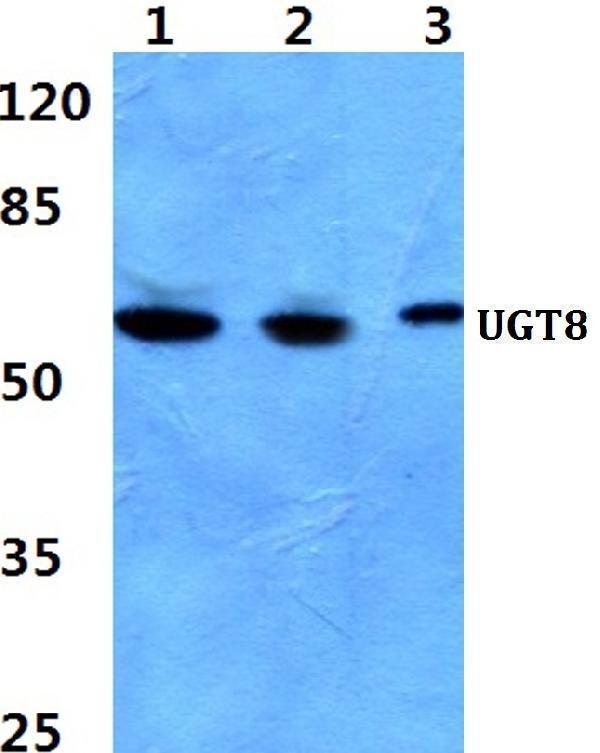 Western blot (WB) analysis of UGT8 polyclonal antibody at 1:500 dilution
Lane1:Hela cell lysate
Lane2:Raw264