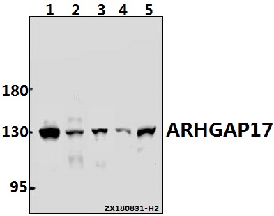 Western blot (WB) analysis of ARHGAP17 (T363) pAb at 1:1000 dilution
Lane1:Hela whole cell lysate(30ug)
Lane2:HCT116 whole cell lysate(40ug)
Lane3:A375 whole cell lysate(40ug)
Lane4:The Embryo tissue lysate of Mouse(40ug)
Lane5:H9C2 whole cell lysate(40ug)