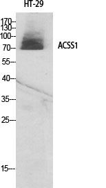 Western Blot (WB) analysis of specific cells using ACSS1 Polyclonal antibody