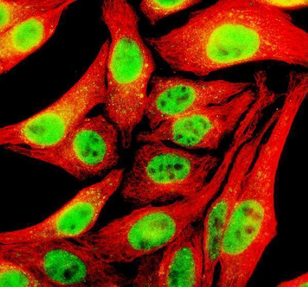 a07976 1 tfap4 primary antibodies if testing 1