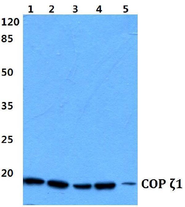 Western blot (WB) analysis of COP ζ1 (I48) polyclonal antibody at 1:500 dilution
Lane1:Hela cell lysate
Lane2:HEK293T cell lysate
Lane3:sp2/0 cell lysate
Lane4:H9C2 cell lysate
Lane5:PC12 cell lysate