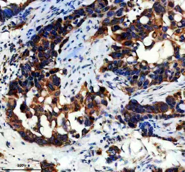 IHC analysis of NANOS2 using anti-NANOS2 antibody (A07978-2)