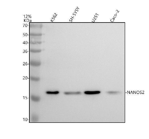 Western blot analysis of NANOS2 using anti-NANOS2 antibody (A07978-2)
