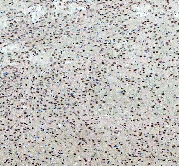 a07980 1 prmt8 primary antibodies ihc testing 3_1