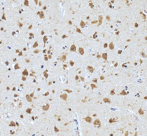a07980 1 prmt8 primary antibodies ihc testing 5