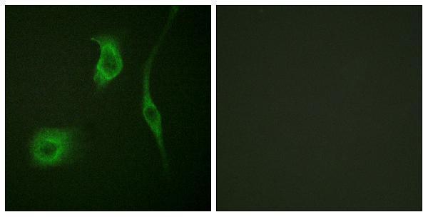 a07981s16 hspb6 primary antibodies if testing 3