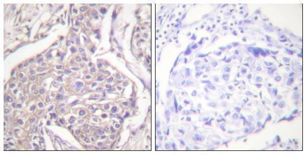 a07981s16 hspb6 primary antibodies ihc testing 2