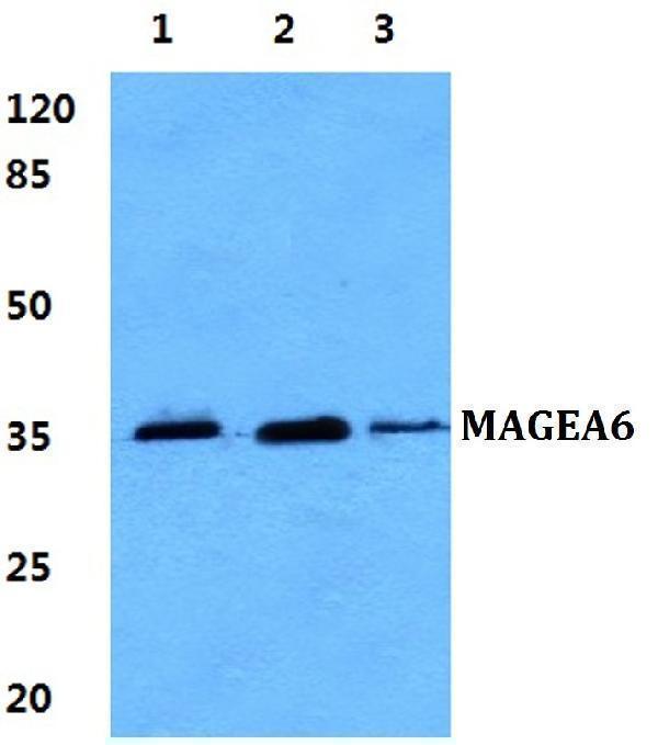 Western blot (WB) analysis of MAGEA6 polyclonal antibody at 1:500 dilution
Lane1:MCF-7 cell lysate
Lane2:NIH-3T3 cell lysate
Lane3:H9C2 cell lysate