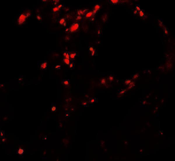 Immunofluorescence of BAMBI in human lung tissue with BAMBI antibody at 20 μg/ml