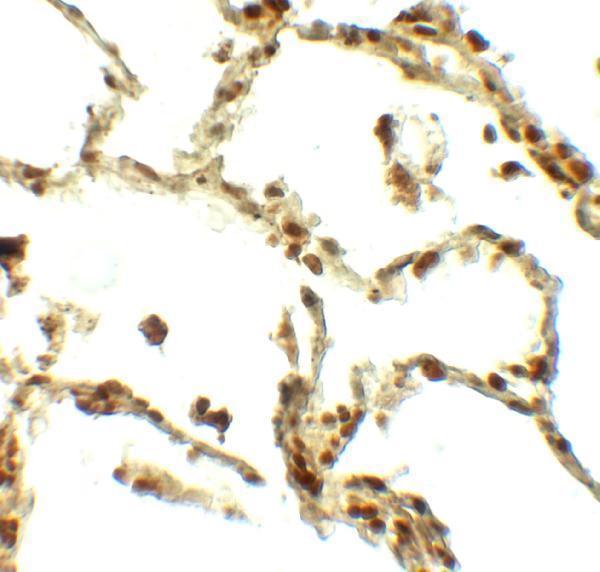 Immunohistochemistry of BAMBI in human lung tissue with BAMBI antibody at 5 μg/ml