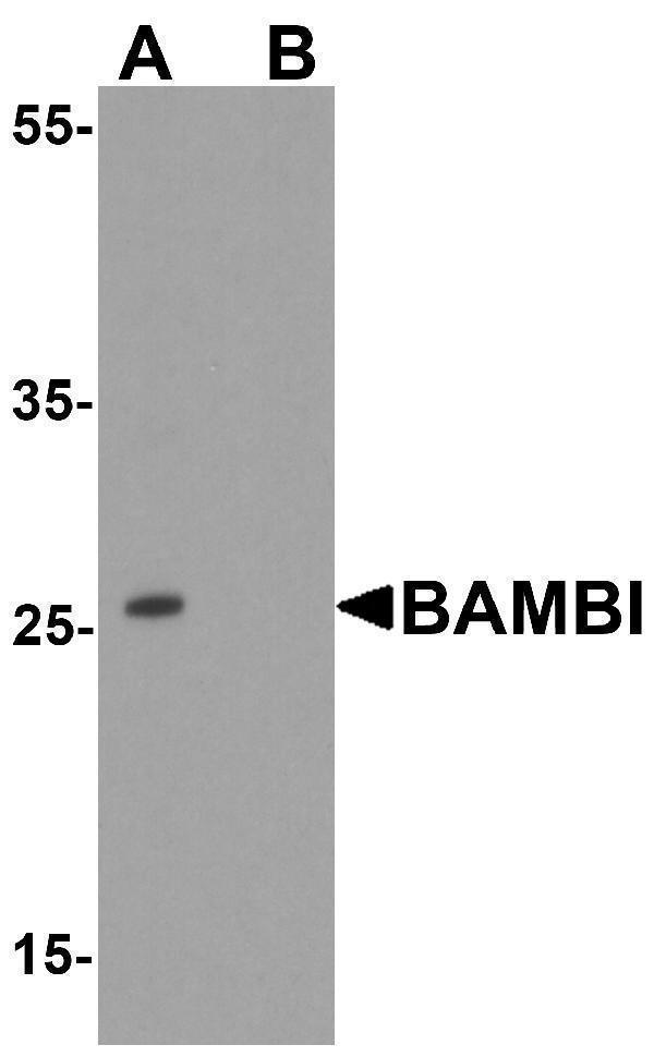 Western blot analysis of BAMBI in mouse lung tissue lysate with BAMBI antibody at 1 μg/ml in (A) the absence and (B) the presence of blocking peptide