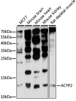 Western blot analysis of extracts of various cell lines, using ACYP2 antibody
