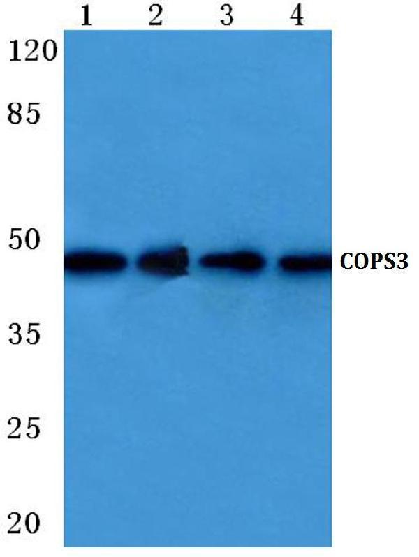 Western blot (WB) analysis of COPS3 (M408) polyclonal antibody at 1:500 dilution
Lane1:Hela cell lysate
Lane2:sp2/0 cell lysate
Lane3:Mouse liver tissue lysate
Lane4:Rat liver tissue lysate