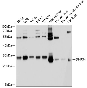 a07990 1 dhrs4 primary antiboties wb testing 1