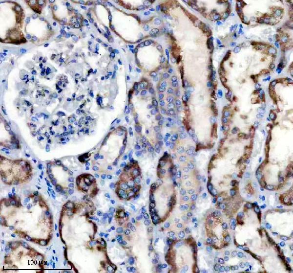 IHC analysis of DHRS4 using anti-DHRS4 antibody (A07990-2)