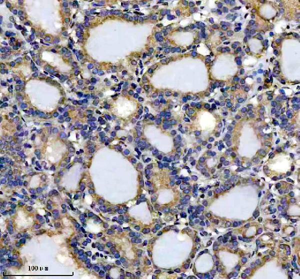 IHC analysis of DHRS4 using anti-DHRS4 antibody (A07990-2)