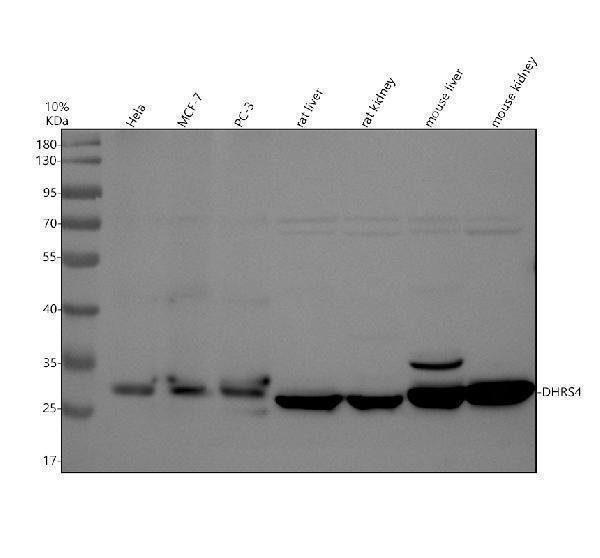Western blot analysis of DHRS4 using anti-DHRS4 antibody (A07990-2)