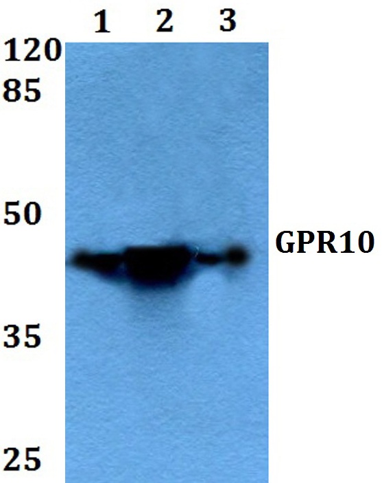 a07994 prlhr primary antiboties wb testing 1