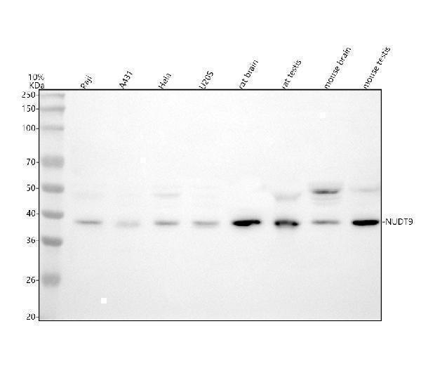 Western blot analysis of NUDT9 using anti-NUDT9 antibody (A07995)